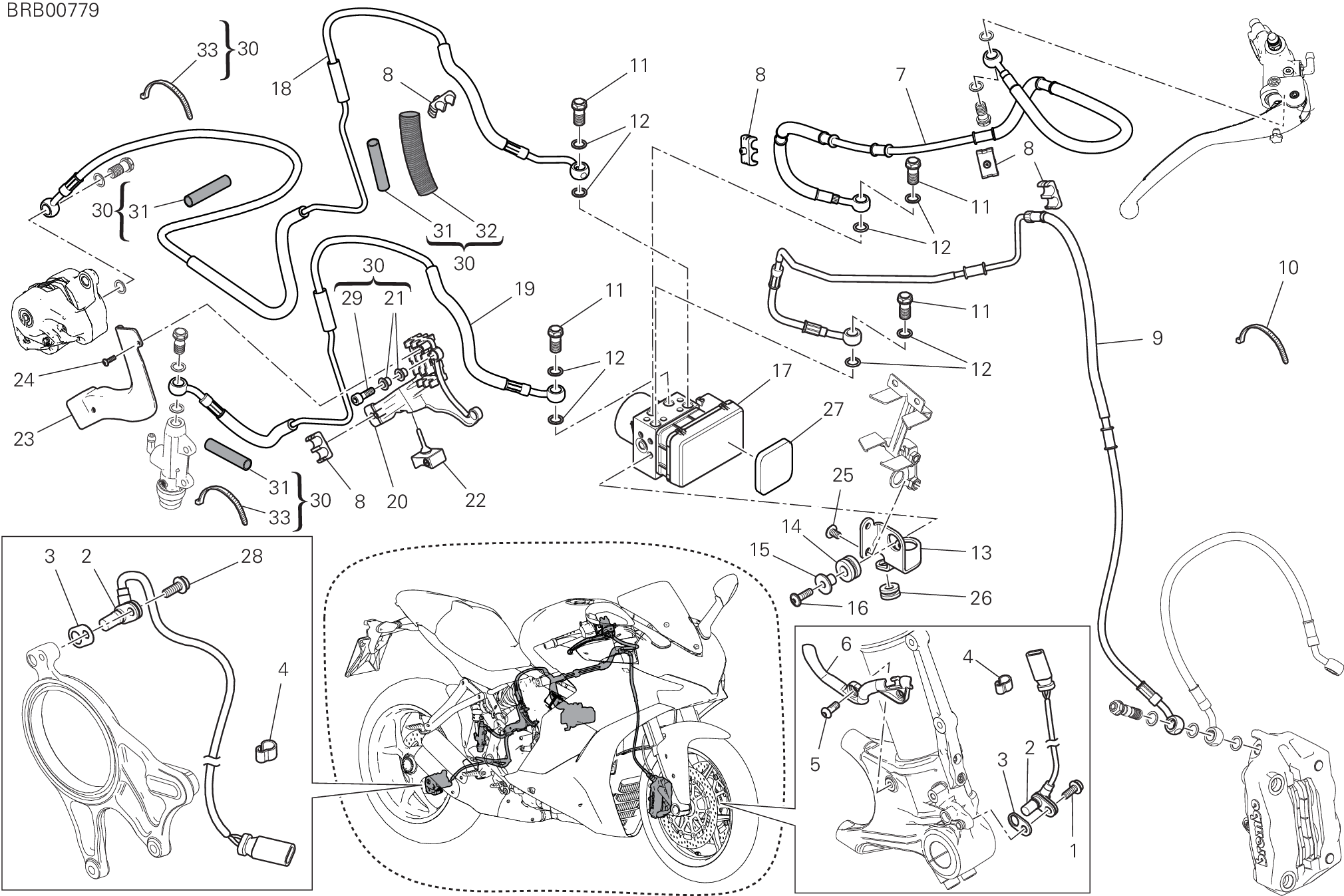 24A SYSTEME ANTIBLOCAGE DES FREINS ABS POUR SUPERSPORT S 2017